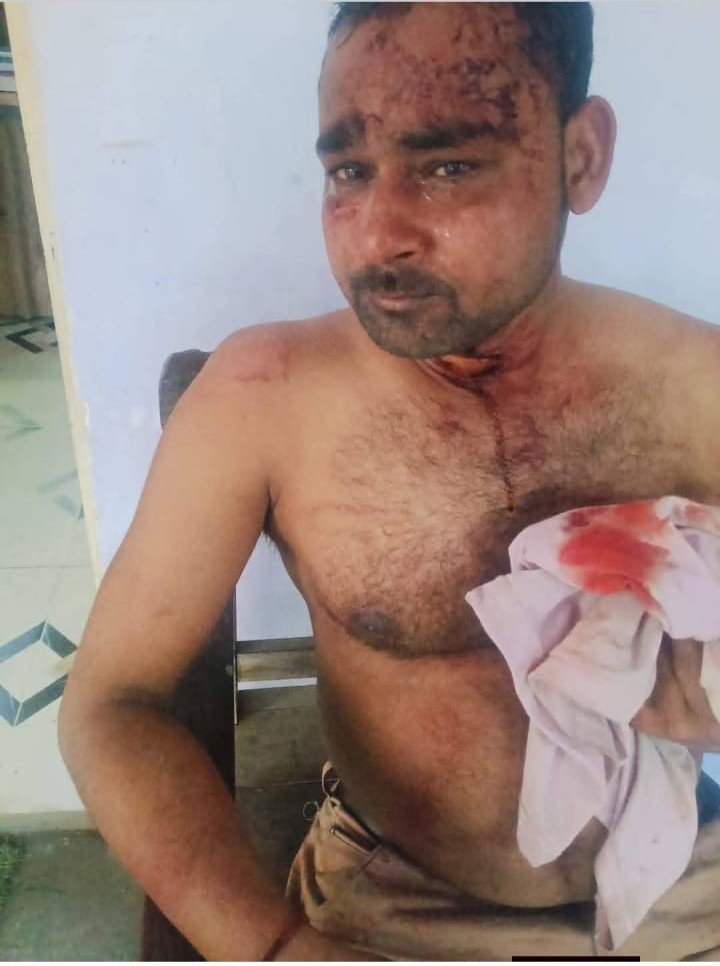 पीड़ित अवनीश