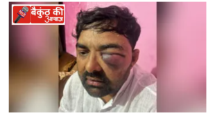 मेरठ में भारतीय किसान यूनियन (बीआर अंबेडकर) के राष्ट्रीय अध्यक्ष डॉ. दिग्विजय भाटी और जिला अध्यक्ष मोहित जाटव ने पुलिस कस्टडी और वरिष्ठ अधिकारियों के कार्यालय में बर्बरतापूर्वक पिटाई किए जाने का गंभीर आरोप लगाया है।